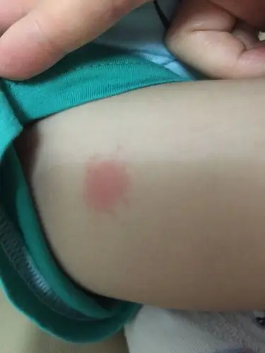 虫子的照片没拍到.大家