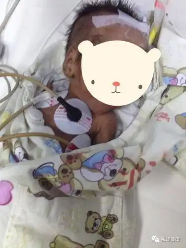 "放弃治疗"8天的试管婴儿奇迹存活,父母口袋里却只剩不到100元