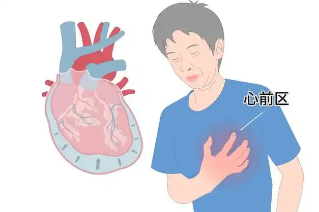 偶尔感到胸闷胸痛这是心脏的呼救信号做好预防小心心绞痛
